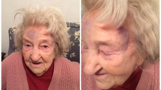 "A fost un atac dezgustator". O batrana de 87 de ani, batuta cu bestialitate pentru verigheta de aur de pe mana