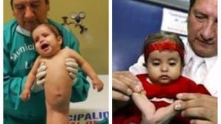 "Fetita sirena" uimea o lume intreaga cu povestea ei! Anii au trecut, iar micuta a crescut! Cum arata acum