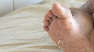 Mama a doi copii, condamnata sa traiasca tintuita la pat din cauza bolii! Piciorul drept cantareste 60 de kilograme