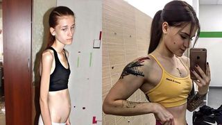 Cantarea doar 32 de kilograme si era piele si os! Cum arata acum tanara care a socat intreaga lume cu aparitia ei