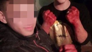 Crimă oribilă în Republica Moldova! Doi adolescenţi au ucis în bătaie un bărbat şi apoi şi-au făcut selfie cu mâinile mânjite de sânge