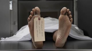 Experiment inedit. Regenerarea creierului pacientilor aflati in moarte clinica ar putea fi posibila