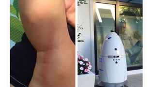 Un copil de 16 luni din SUA a fost lovit in repetate randuri de un robot Knightscope K5