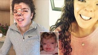 "Bunicul ei mergea in fiecare zi, in pauza de pranz, la ea la scoala ca sa n-o lase singura". O tanara, nascuta cu o boala rara, are in sfarsit parte de o viata normala dupa o operatie la fata