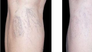 Aveti vase sparte si fumati? Este timpul sa renuntati la acest viciu. Iata ce efect nociv au tigarile asupra metabolismului