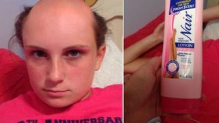 Ce a patit o tanara care ar fi incurcat samponul cu crema depilatoare. Modificata sau nu, imaginea cu ea a devenit virala