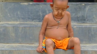 Are numai 4 ani si arata ca un batran. "La 3 luni avea deja un set de dinti"- De ce boala sufera si ce spun medicii - Povestea lui e dureroasa