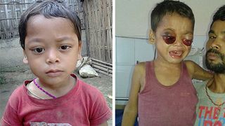 Suferinta ingrozitoare pentru un baietel de numai patru ani. A inceput sa planga cu lacrimi de sange, dar acum ochii i-au explodat in orbite. Doctorii n-au vazut niciodata un asemenea caz