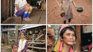 "Femeile-girafa" din Burma (Myanmar). Inelele grele de alama le intind femeilor gatul in semn de frumusete si statut social