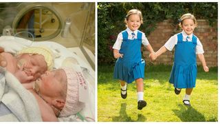 Desi nimeni nu le dadea nicio sansa la viata, gemenele care s-au nascut lipite in zona abdomenului au sarbatorit prima zi de scoala