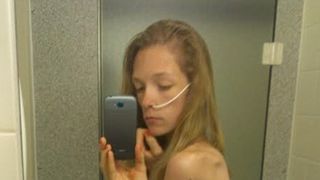 O adolescenta aflata la un pas de moarte din cauza anorexiei a postat fotografii cu ea pe internet. Ce s-a intamplat dupa ce imaginile au devenit virale