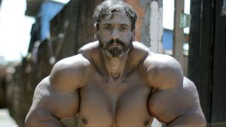 Un culturist isi injecteaza ulei in muschi pentru a arata ca Hulk! Desi aceasta substanta ii pune viata in pericol, el nu renunta! Bratele lui arata ca si cum vor exploda