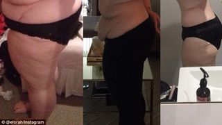 Transformarea incredibila a acestei obeze. A slabit 55 de kilograme, si-a taiat 2.5 de kg de piele ramasa in exces si acum e de nerecunoscut