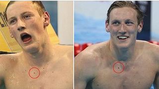 Un fan i-a salvat viata lui Mack Horton, campion olimpic la inot! Acesta a observat ca alunita de pe pieptul sportivului si-a schimbat dimensiunea si culoarea