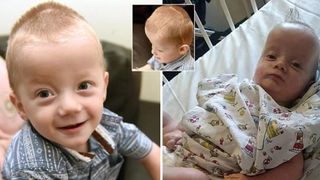 Bebelusul care s-a nascut cu un cap imens, ca al unui adult, poate sa duca de acum o viata normala. El a fost operat cu succes