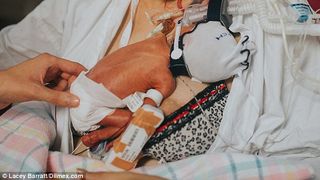 Cand s-a nascut avea putin peste 800 de grame si masura cat o rigla. Povestea fetitei nascuta la doar 27 de saptamani care a sfidat prognosticul medicilor. Imagini emotionante