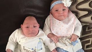 Desi medicii nu i-au dat nicio sansa la viata, fetita nascuta cu creierul in afara craniului lupta sa traiasca. A implinit patru luni!