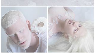 Imagini superbe care arata frumusetea albinosilor. "Aceasta frumusete pura pare a fi desprinsa din basme"