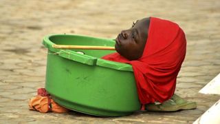 Tanara fara maini si picioare care traia intr-un lighean de plastic a murit in ziua de Craciun