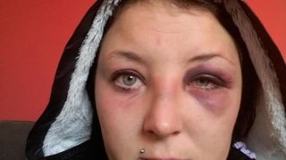 A batut-o pana a lasat-o inconstienta, apoi a tarat-o in strada. Povestea dramatica a unei mame abuzate de sot: "M-a tras ca pe un covor"