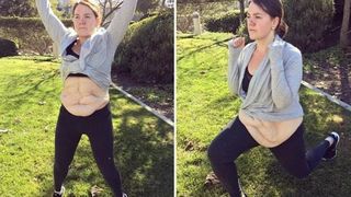 A slabit aproape 70 de kilograme, dar acum se lupta cu excesul de piele. Tanara de 23 de ani a aratat intregii lumi cu ce se confrunta zilnic