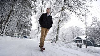 Barbatul care a suferit un transplant de fata dupa ce s-a impuscat este schimbat complet. Acum, el are nasul, obrajii, gura, barbia si chiar si dintii altcuiva