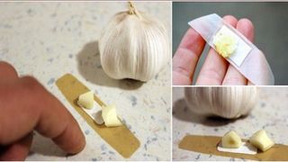 Pune un plasture cu o bucatica de usturoi pe piele, iar rezultatul te va ului! Vei scapa de negi ca prin minune