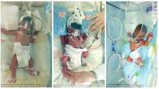 Frati tripleti, nascuti la interval de 7 zile. Micutii au fost adusi pe lume pe cale naturala