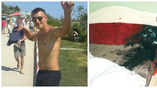 Tanar roman, desfigurat dupa ce iubita geloasa i-a turnat acid pe fata. Femeia este o britanica de 52 de ani