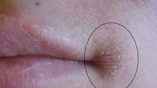 Ai avut vreodata asa ceva? Mare grija! Ai putea sa ai o afectiune grava