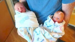 A nascut gemeni identici, dar dupa doi ani a realizat o diferenta infioratoare - Doamne, ce trist