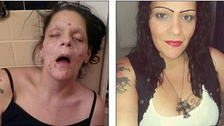 "Eram bolnava. Muream. Nu am crezut ca pot sa imi revin". Cum a ajuns mama a doua fetite sa arate in halul asta