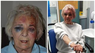 "Am crezut ca mor". Pensionara, de 82 de ani, strangulata cu lesa de la caine si batuta mar de o femeie, chiar in propria casa