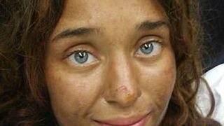 O tanara de 25 de ani, data disparuta in urma cu o luna, a fost gasita in padure. A supravietuit mancand mure si ciuperci salbatice