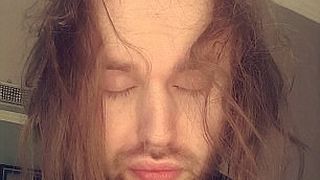 Era atat de rusinat ca nu are par pe cap incat nu a mai facut sex 3 ani! Cum arata acum barbatul