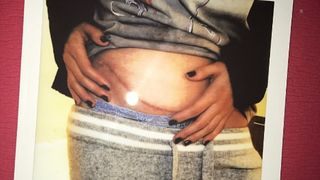 Emotionant. Cea mai buna prietena i-a facut cel mai frumos cadou: un transplat de rinichi. Cantareata sufera de boala cumplita.