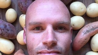 Timp de un an de zile s-a hranit exclusiv numai cu cartofi! Cum a ajuns sa arate acest barbat