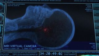 Ce se intampla in creier in momentele de dinaintea mortii