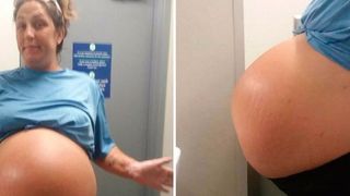 A ramas insarcinata pentru a patra oara, insa burta ii crestea mai mult si mai repede, asa ca a intrat in panica. I-au facut cezariana de URGENTA si, cand au vazut ce crestea in ea, au inceput sa tipe in sala de operatie! Uite ce a nascut femeia
