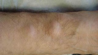 Avea doua umflaturi pe mana dreapta. Toata lumea il ocolea cand purta tricouri - Ce a decis sa faca intr-o zi! A amestecat faina cu miere si&hellip;