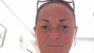 I-a aparut un cos in zona cotului si a intrat in coma timp de 3 saptamani! Ce au descoperit medicii cand a ajuns de urgenta la spital