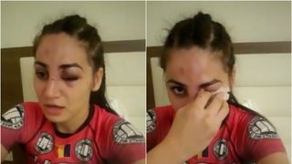 O adevarata luptatoare. Diana Belbita, cu ochiul vanat si sange pe chip. Imaginile care i-au ingrijorat pe multi