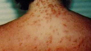 Pericol urias in apele marii! Aveti grija! Zeci de persoane au patit-o rau de tot!