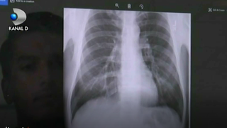 O aplicatie online citeste gratuit radiografii si pune diagnostice. Este inventia unor studenti de la Universitatea Politehnica din Timisoara