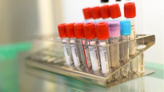 "Superbacteriile" sunt din ce in ce mai rezistente la dezinfectanti. Rezultatele unui strudiu recent sunt ingrijoratoare