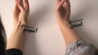 Ti se vede sau nu acest tendon la mana? Vezi ce spune asta despre tine! E mai bine sa nu il ai!