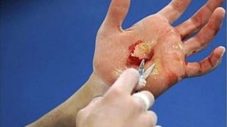 Imaginea postata de Silvia, cu mana unei gimnaste, este socanta