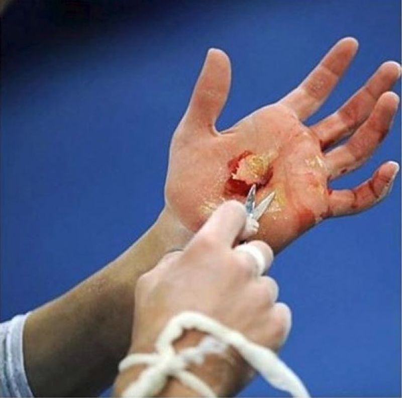 Imaginea postata de Silvia, cu mana unei gimnaste, este socanta