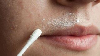 Solutia minune care te scapa de parul de pe fata. Procedura simpla pe care o poti face la tine acasa