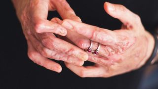 Mărturia cutremurătoare a unei victime din Colectiv! ”Ţip şi îl implor să se oprească, dar el continuă să lucreze, ca un robot al răului a cărui singură comandă este  >”